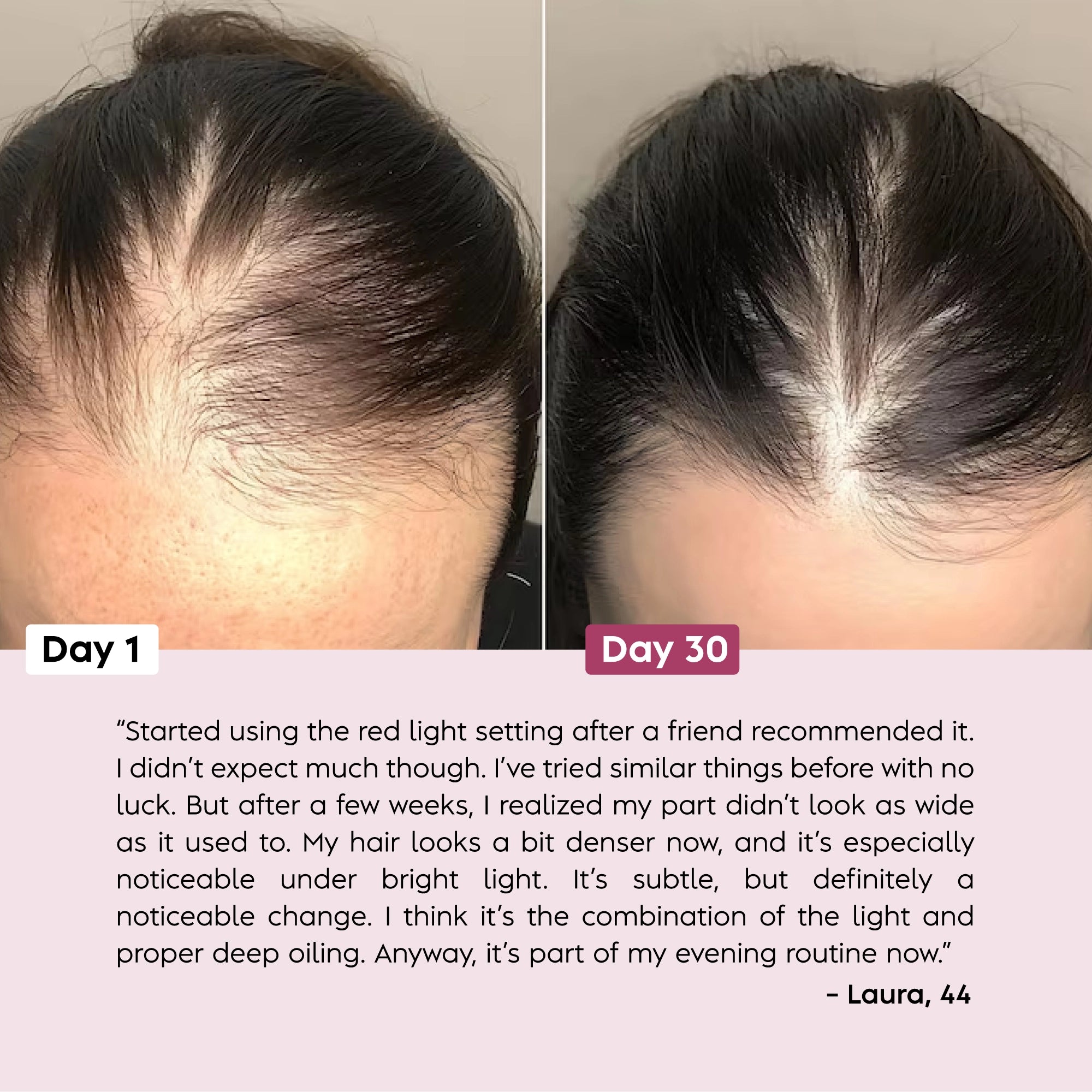 Scalpistry™ Scalp & Hair Growth Therapy Comb